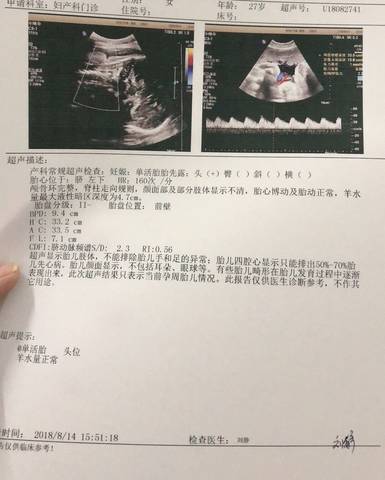journal_insert_pic_1074491440