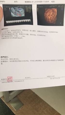 journal_insert_pic_1075067004