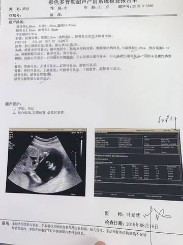 journal_insert_pic_1075143646