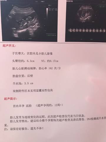 journal_insert_pic_1075061318