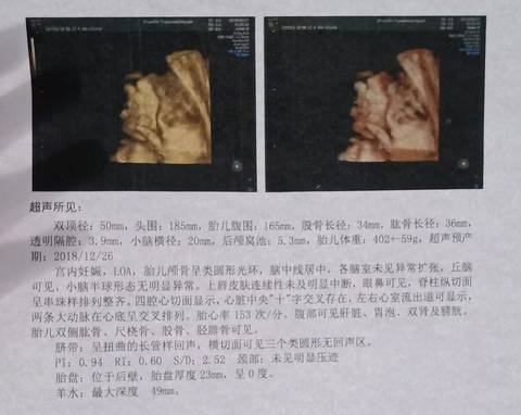 journal_insert_pic_1075826567