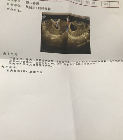 journal_insert_pic_1076217746