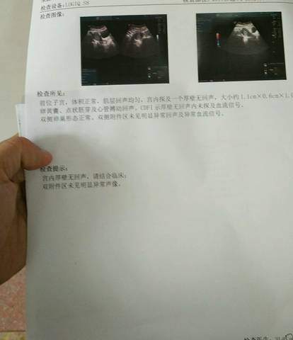 journal_insert_pic_1078285753