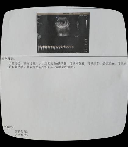 journal_insert_pic_1078094617