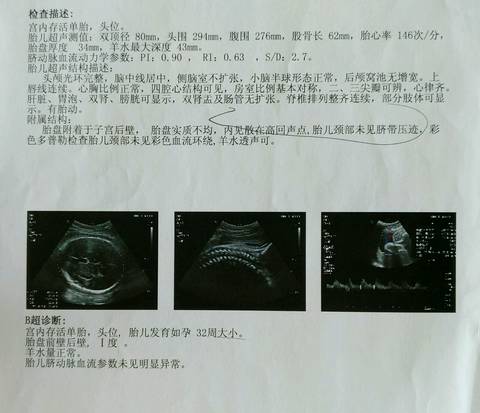journal_insert_pic_1078805731
