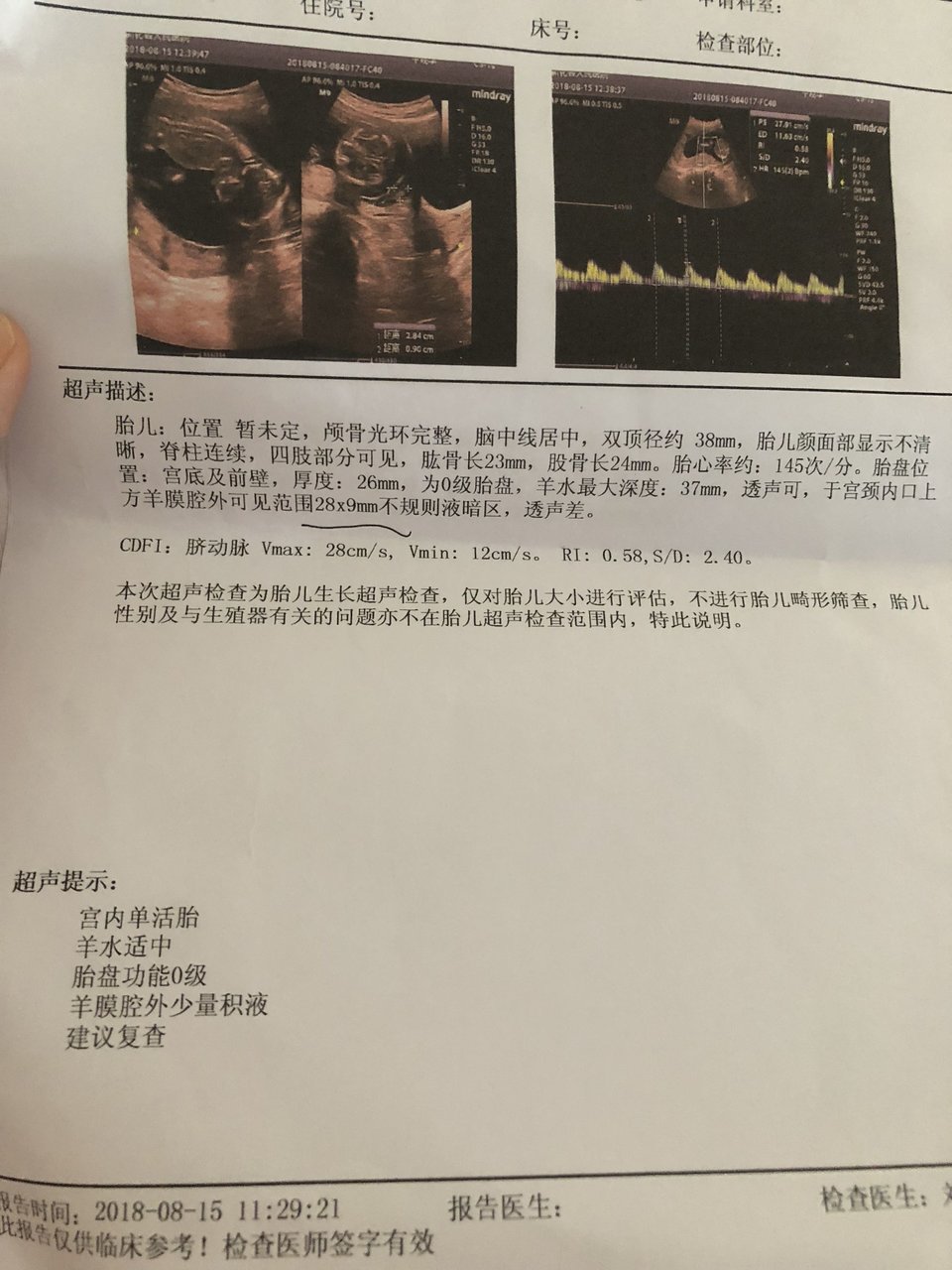 16周流姨妈血 一直有宫腔积液  好担心