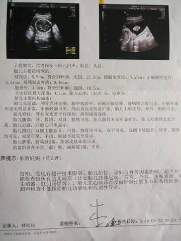journal_insert_pic_1078757307