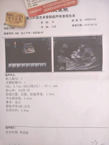journal_insert_pic_1079394167
