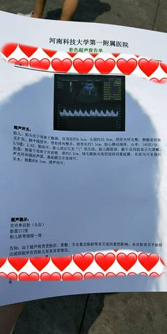 journal_insert_pic_1079351559