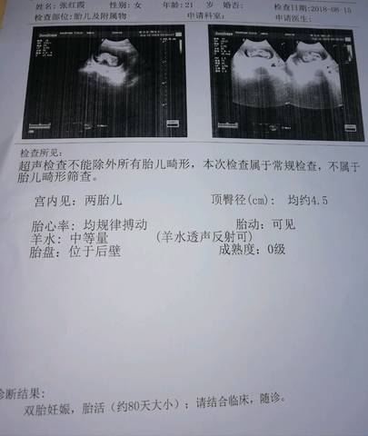 journal_insert_pic_1079993741