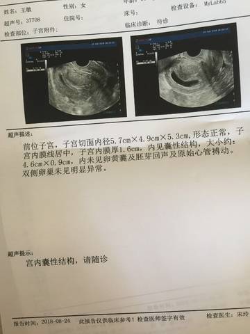 journal_insert_pic_1080123416