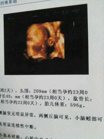 journal_insert_pic_1080638491
