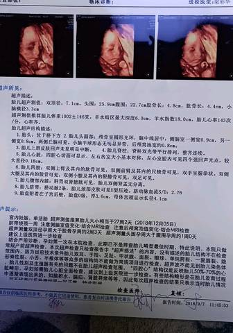 journal_insert_pic_1088787018
