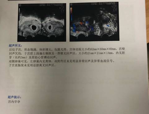 journal_insert_pic_1089226939