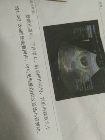 journal_insert_pic_1090645403