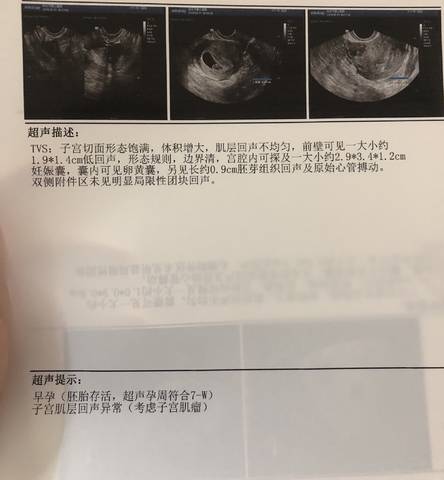 journal_insert_pic_1090996350