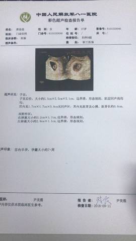 journal_insert_pic_1091350845