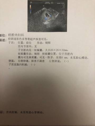 journal_insert_pic_1090999121