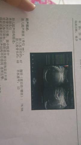 journal_insert_pic_1092741063