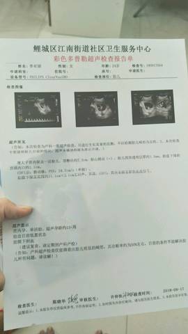 journal_insert_pic_1094538641