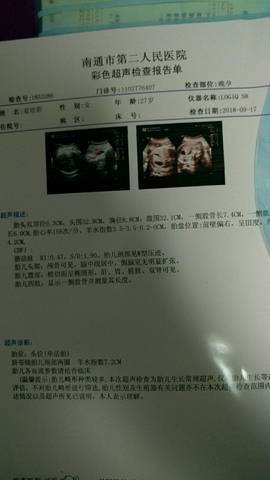 journal_insert_pic_1094740189