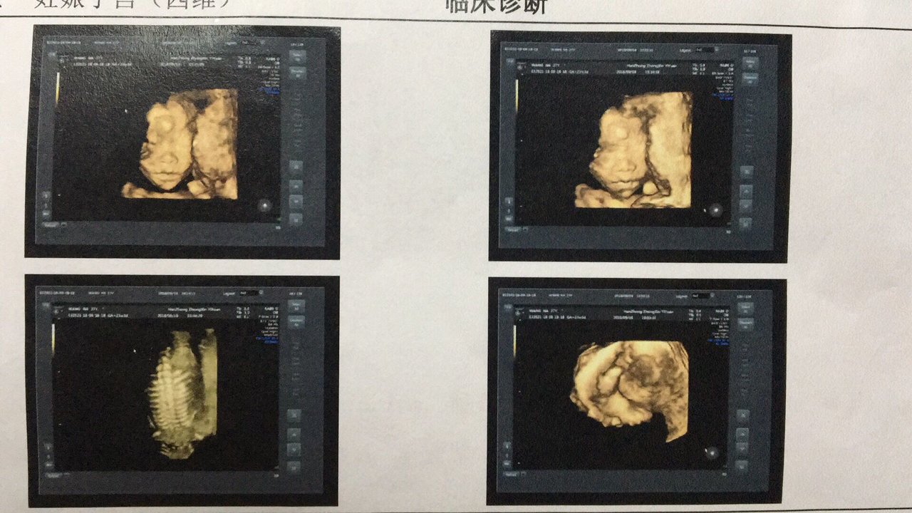 热乎乎的四维出来啦，是男是女哦😊