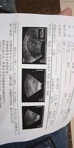 journal_insert_pic_1096245451