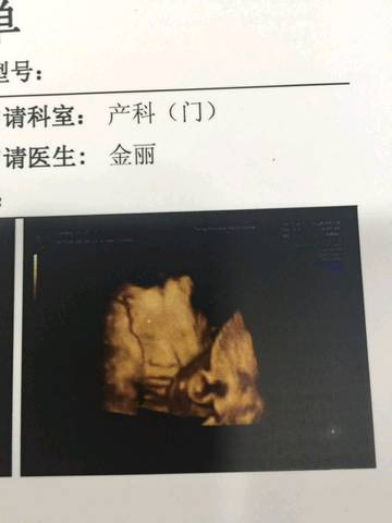 journal_insert_pic_1097105861
