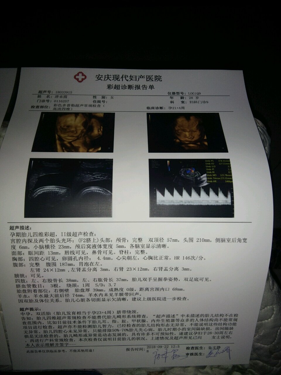 双胎四维顺利通过