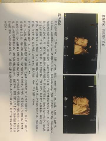 journal_insert_pic_1099913718