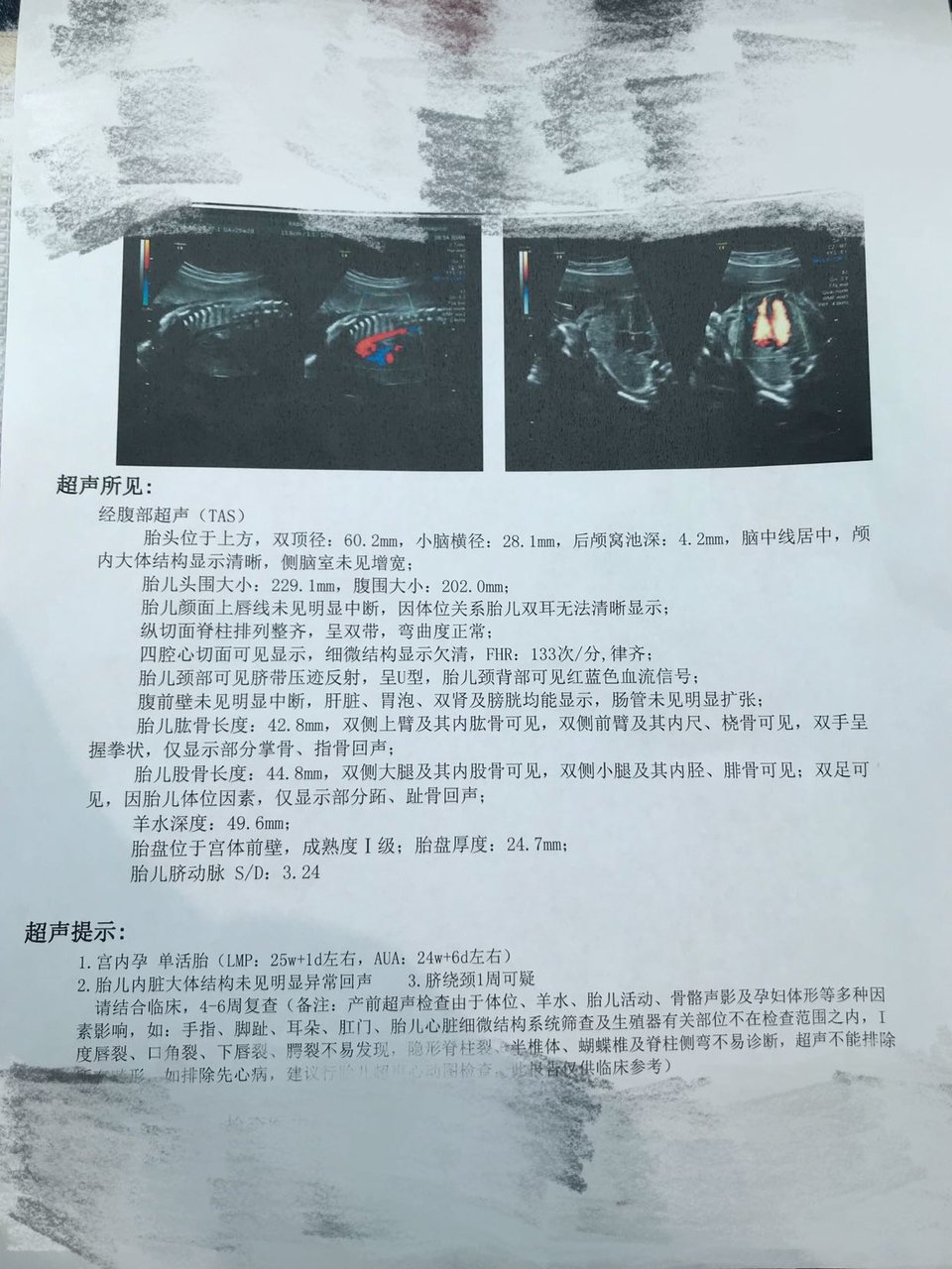 宝妈们接四维顺利通过啦