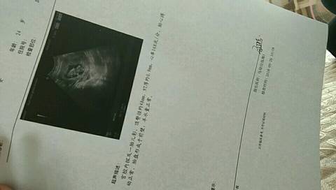 journal_insert_pic_1101656897