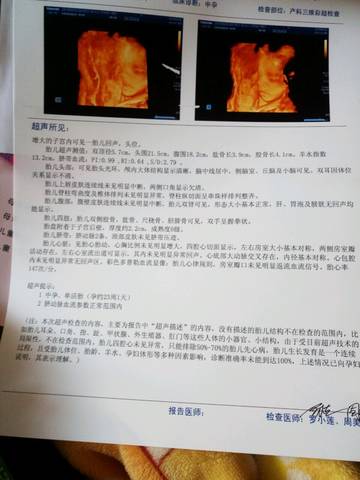 journal_insert_pic_1102237379