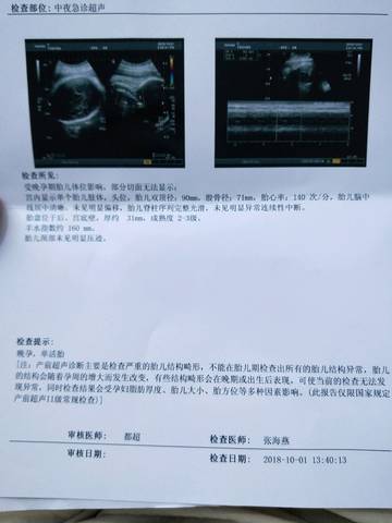 journal_insert_pic_1103105782