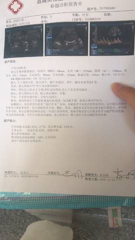 journal_insert_pic_1104445241