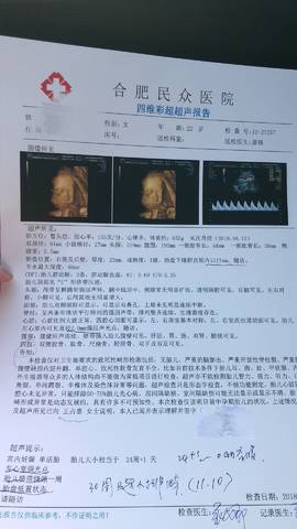 journal_insert_pic_1106124557