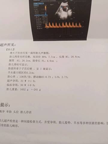 journal_insert_pic_1109681167
