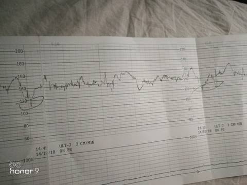 journal_insert_pic_1111592189