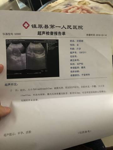 journal_insert_pic_1111484820