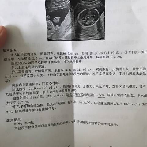 journal_insert_pic_1111610792