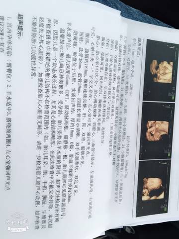 journal_insert_pic_1112192080