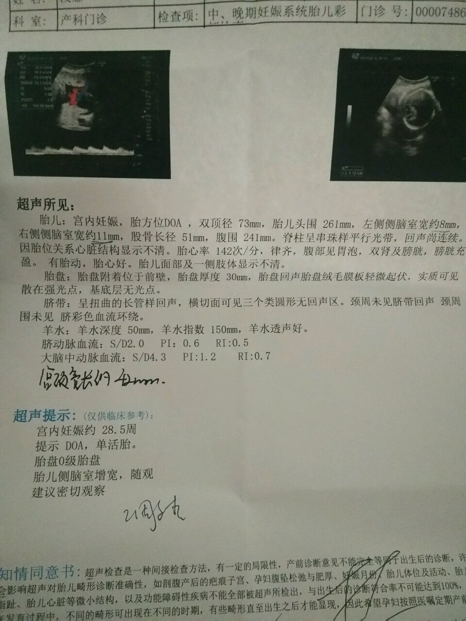 附图，侧脑室宽的宝妈可以放轻松，宝宝很坚强的！