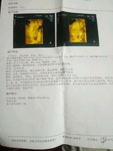 journal_insert_pic_1113027242