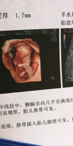 journal_insert_pic_1114136126