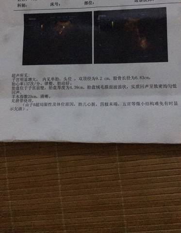journal_insert_pic_1115905691