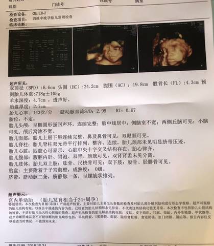 journal_insert_pic_1115989899