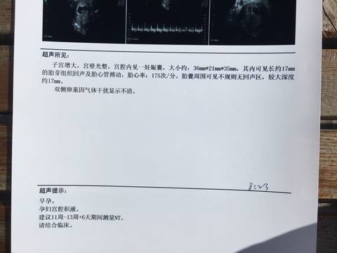 journal_insert_pic_1116972630