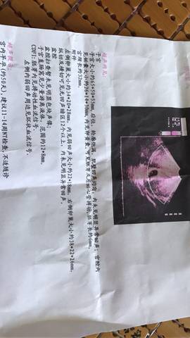 journal_insert_pic_1117871113