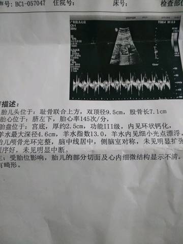 journal_insert_pic_1118466458