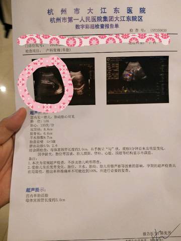 journal_insert_pic_1118246794